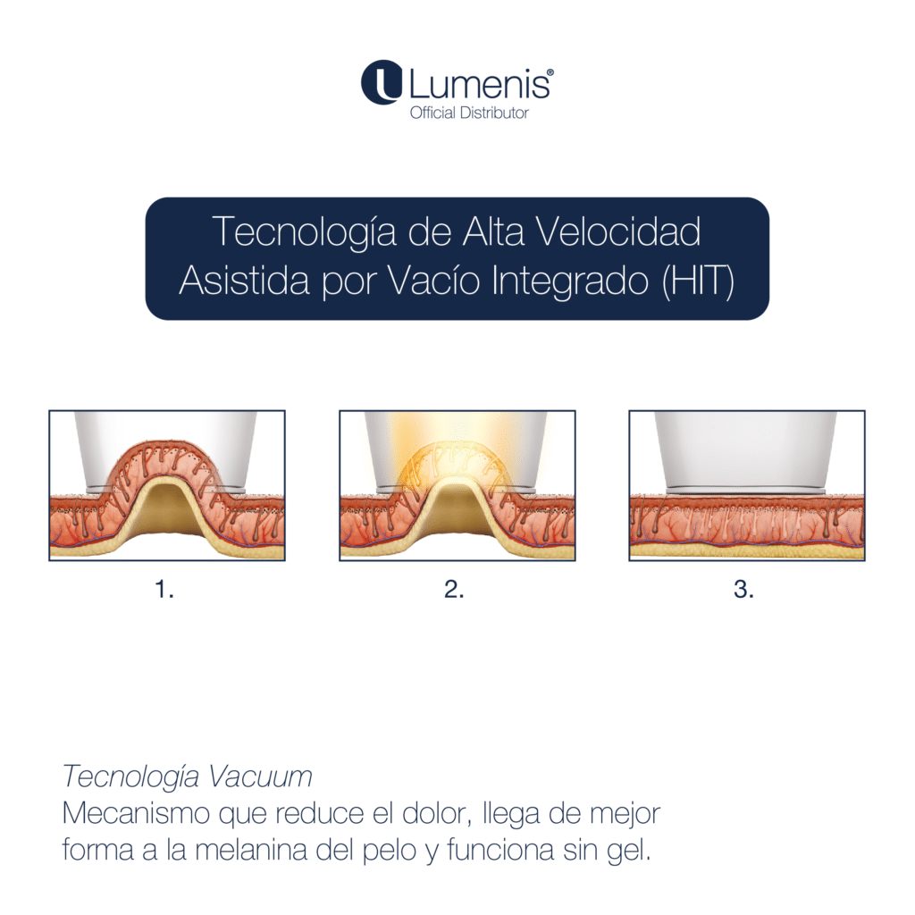 Equipo LightSheer QUATTRO