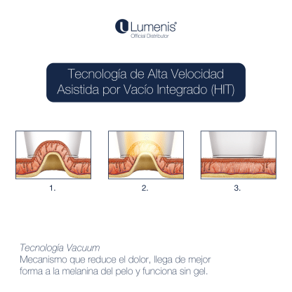 LightSheer QUATTRO - Imagen 4