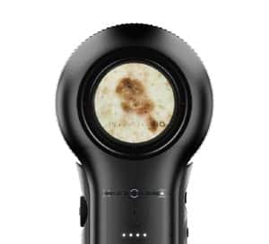 Dermatoscopio Dermlite DL5