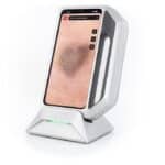 Dermatoscopia digital con Skeen Fotofinder