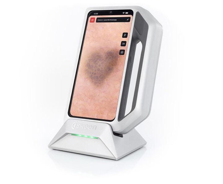 Dermatoscopia digital con Skeen Fotofinder