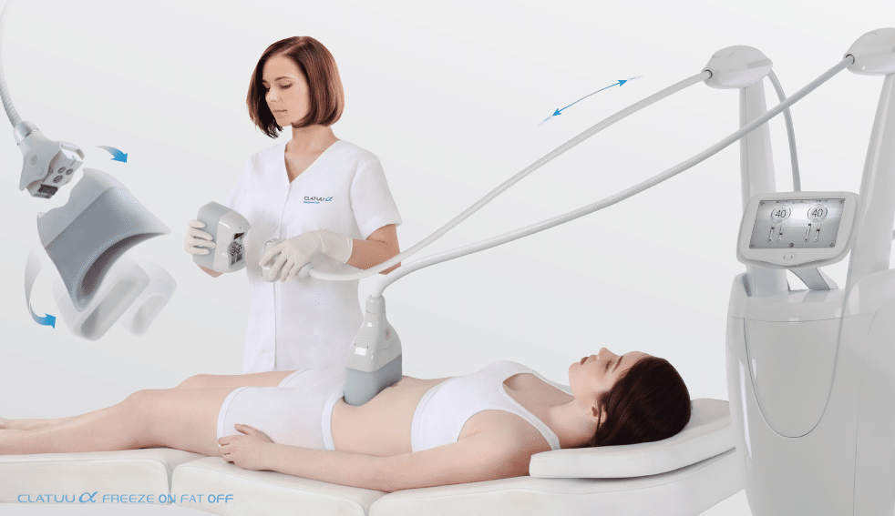 Criolipólisis envolvente de 360° para reducir la grasa localizada – CLATUU Alpha™