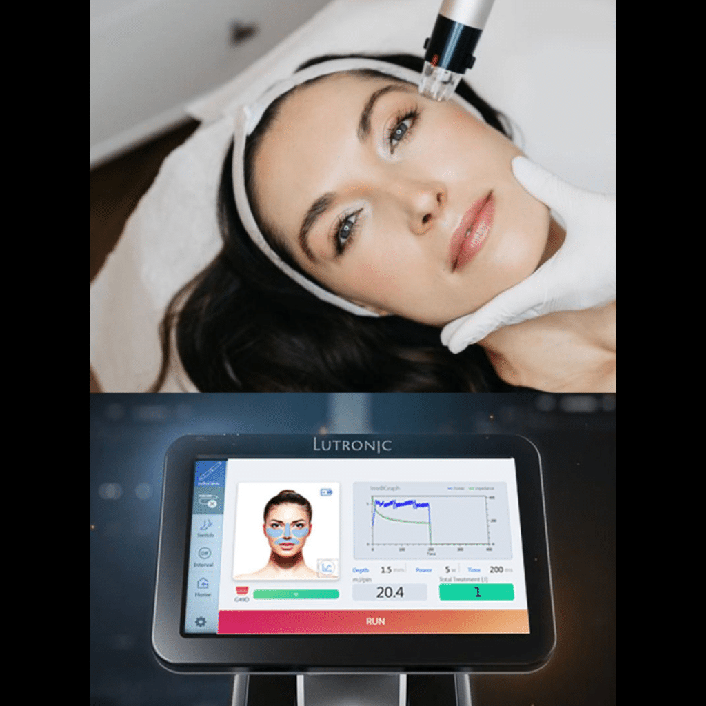 Genius™ microagujas inteligentes
