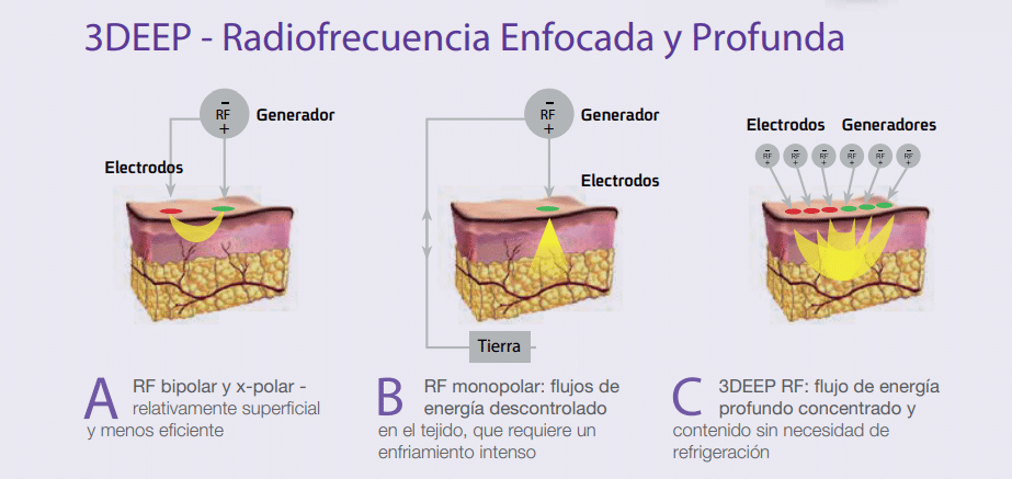 Endymed PRO