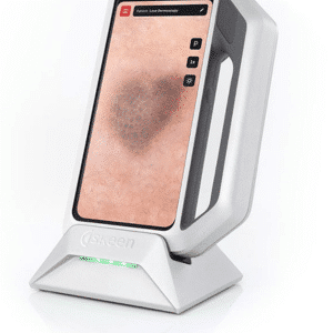 Dermatoscopia digital con Skeen Fotofinder