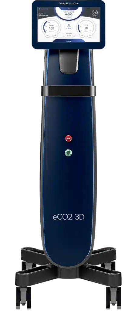 máquina láser CO2
