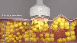 EEFECTO MECANICO Y ATERMICO