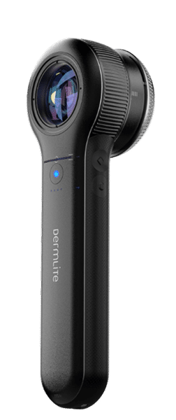 Por qué elegir este equipo – Dermatoscopio Dermlite DL5 plus