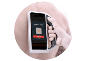 Inteligencia Artificial AIMEE