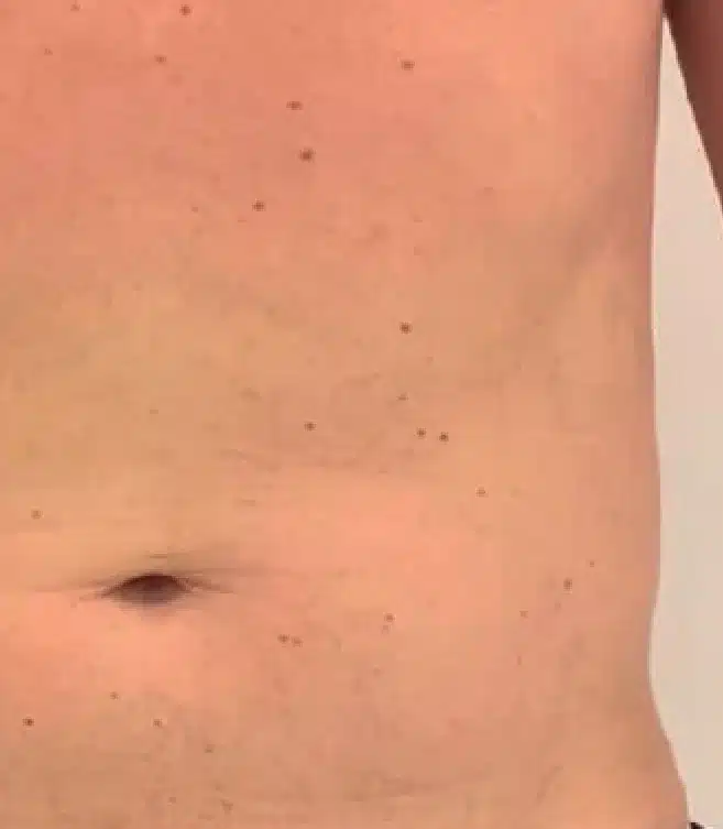 Después de una sesión de 20 minutos con Deep Slim, abdomen