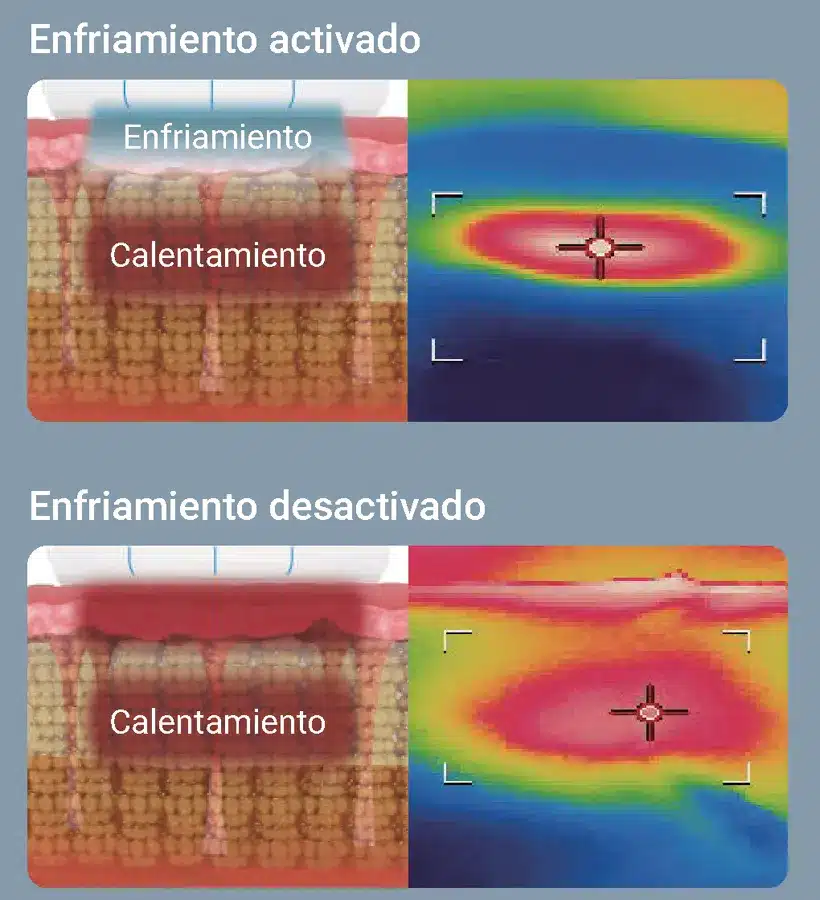 Comparación térmica con el enfriamiento por contacto activado y desactivado